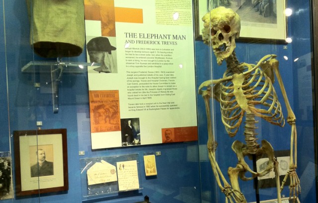 Esqueleto de John Merrick que se conserva en el hospital de Londres